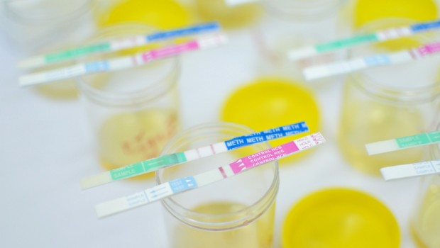 Urine-Drug-Test